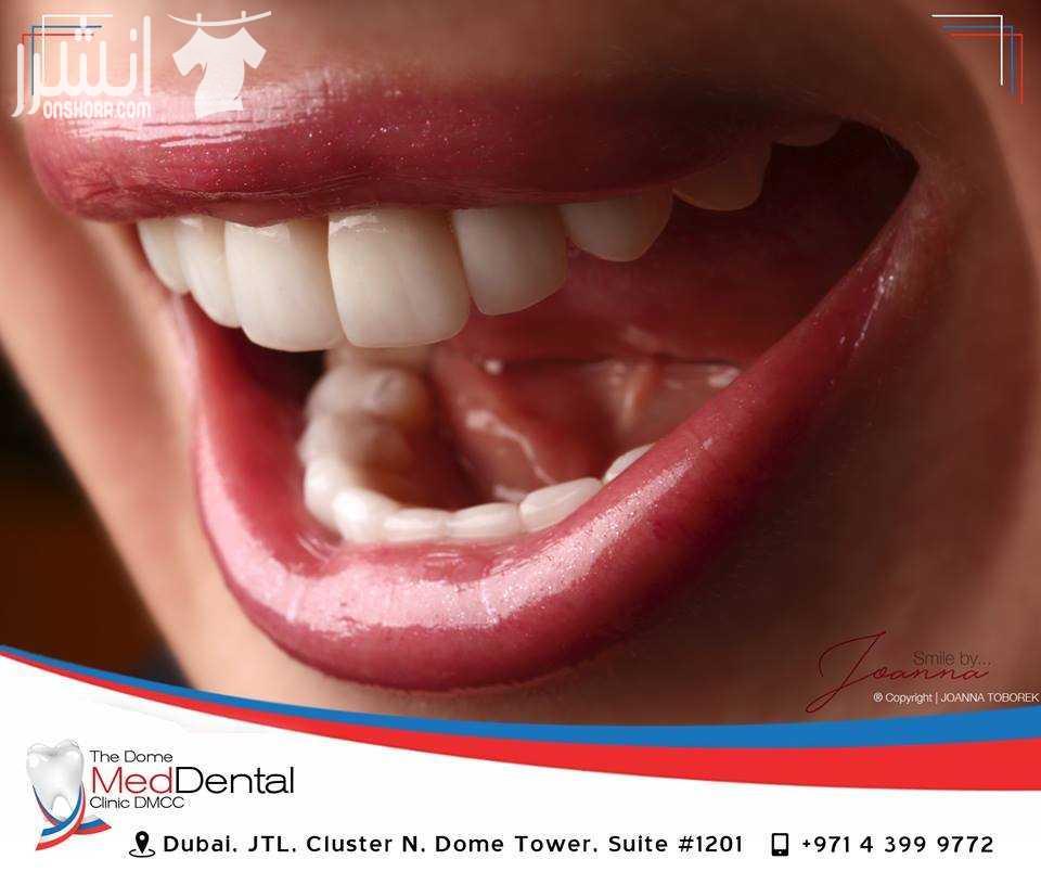 خدمات-طبيةعيادة أسنان مددنتال Meddental <br> <br>عيادة ميد دنتال هي عيادة...
